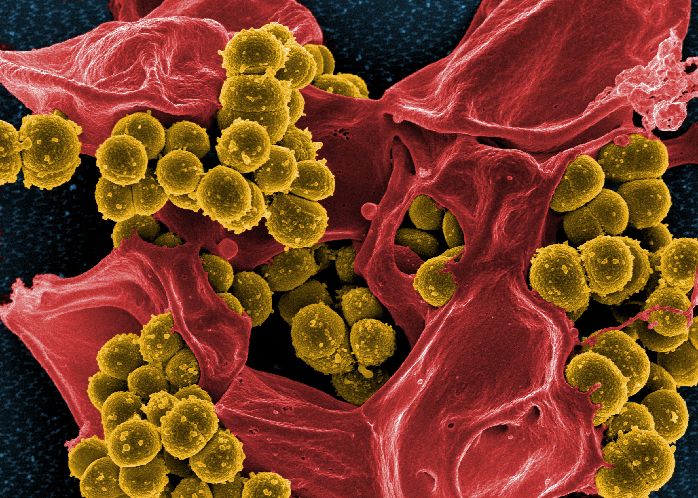 MRSA in Dallas Nursing Homes; Is Your Loved One at Risk?