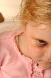 Daycare Abuse Prevention - How to Keep Your Child From Being Abused