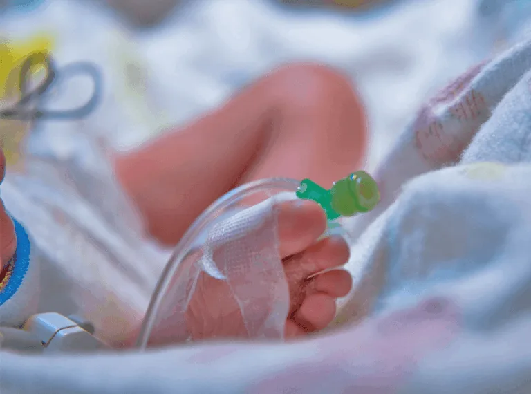 Legal Considerations for Birth Injuries Caused by Premature Delivery