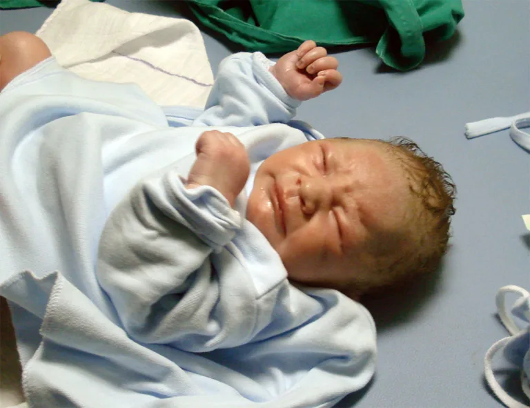 Newborn Bone Fractures