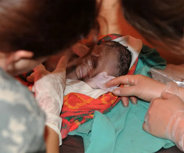 Meconium Aspiration Syndrome Birth Injuries