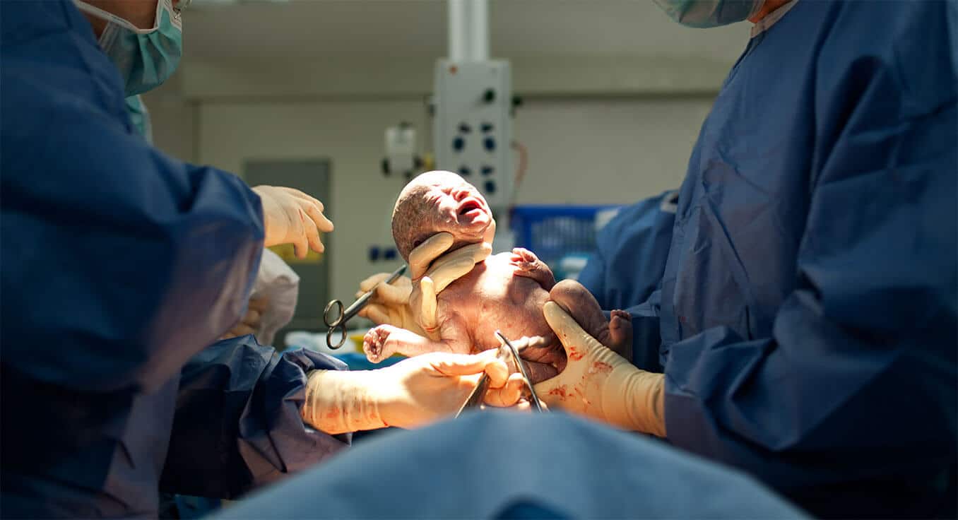 Birth Injuries Caused by a Delayed or Prolonged Delivery