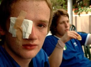 Eye Injuries, Vision Loss and Blindness