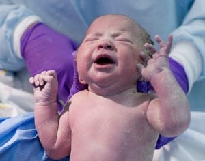 Texas Torticollis Birth Injury Lawyer