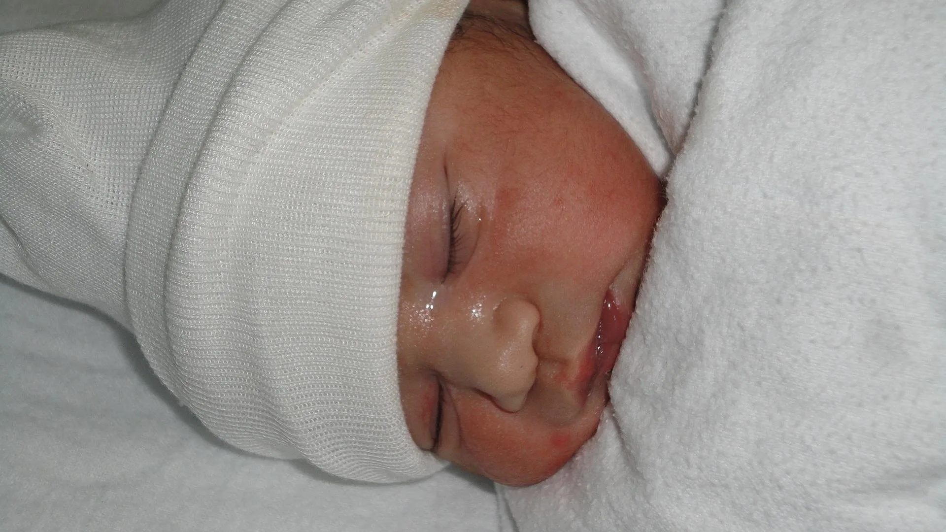 baby hopsital